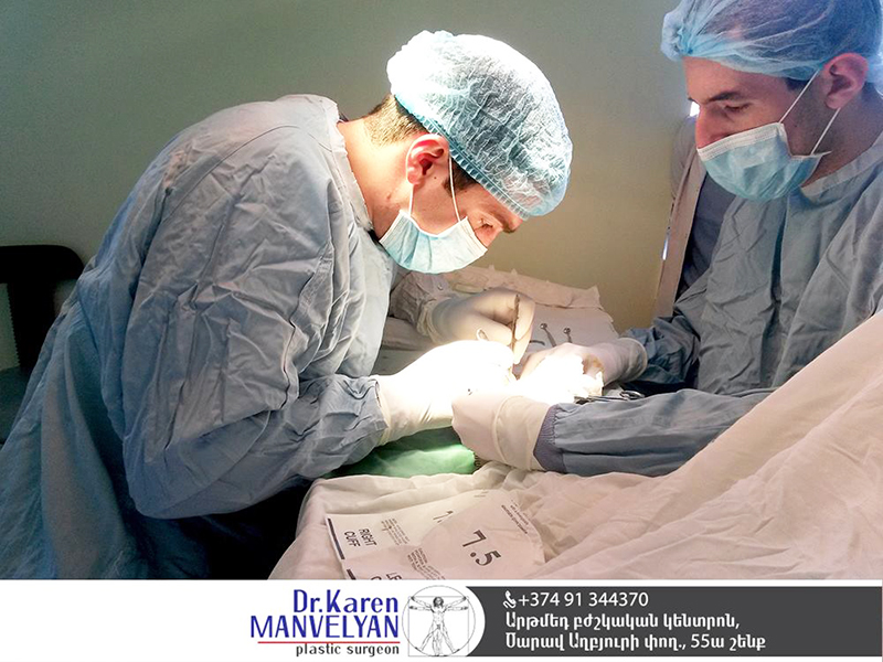 Կրծքի պլաստիկ վիրահատություն.խորհուրդներ պլաստիկ վիրաբույժից